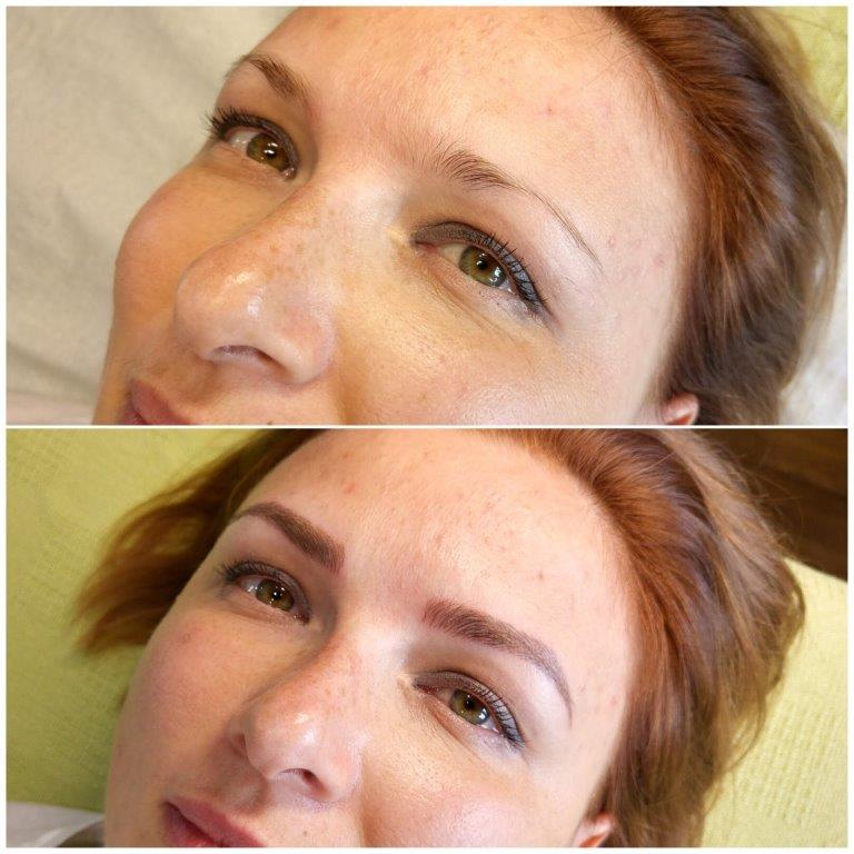 Kozmeticki_Salon_Anela_Microblading_Iscrtavanje_Obrva_Japanskom_Metodom_20170901 (11)