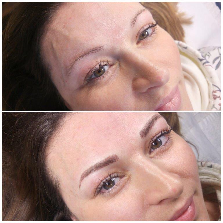 Kozmeticki_Salon_Anela_Microblading_Iscrtavanje_Obrva_Japanskom_Metodom_20180301 (15)