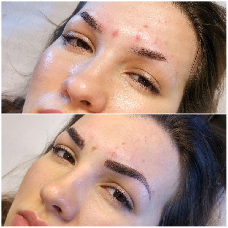 Kozmeticki_Salon_Anela_Microblading_Iscrtavanje_Obrva_Japanskom_Metodom_20170901 (36)