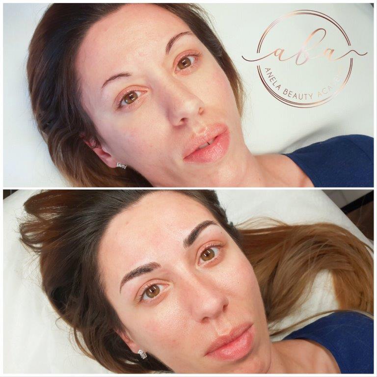 Kozmeticki_Salon_Anela_Microblading_Iscrtavanje_Obrva_Japanskom_Metodom_20190101 (24)