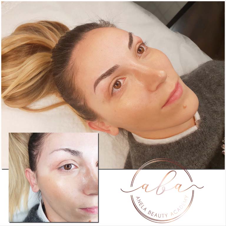 Kozmeticki_Salon_Anela_Microblading_Iscrtavanje_Obrva_Japanskom_Metodom_20190901 (7)
